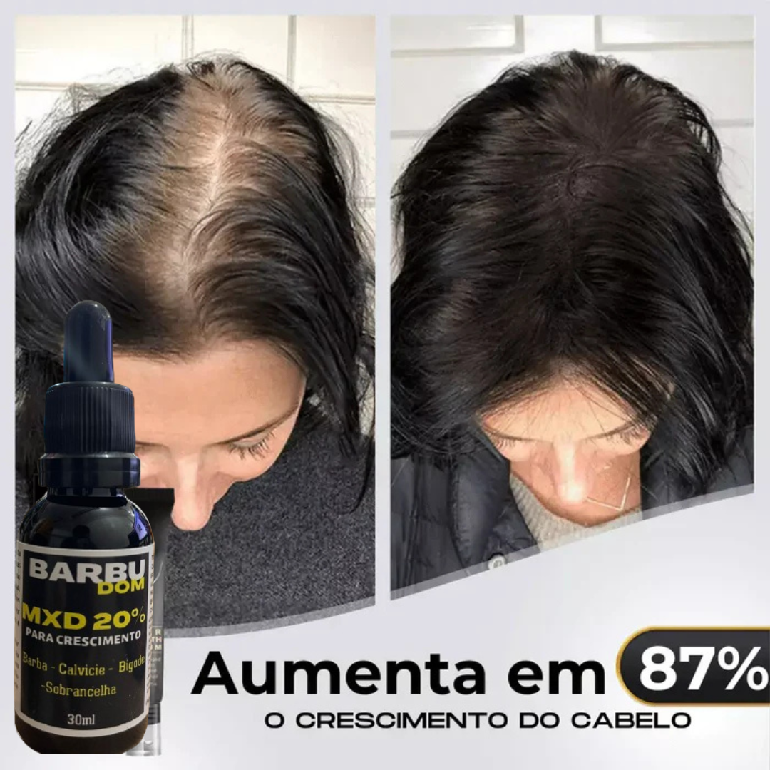 Resultado apresentado do MXD20